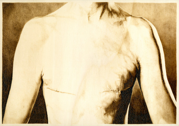 Dubbel, torso mindre